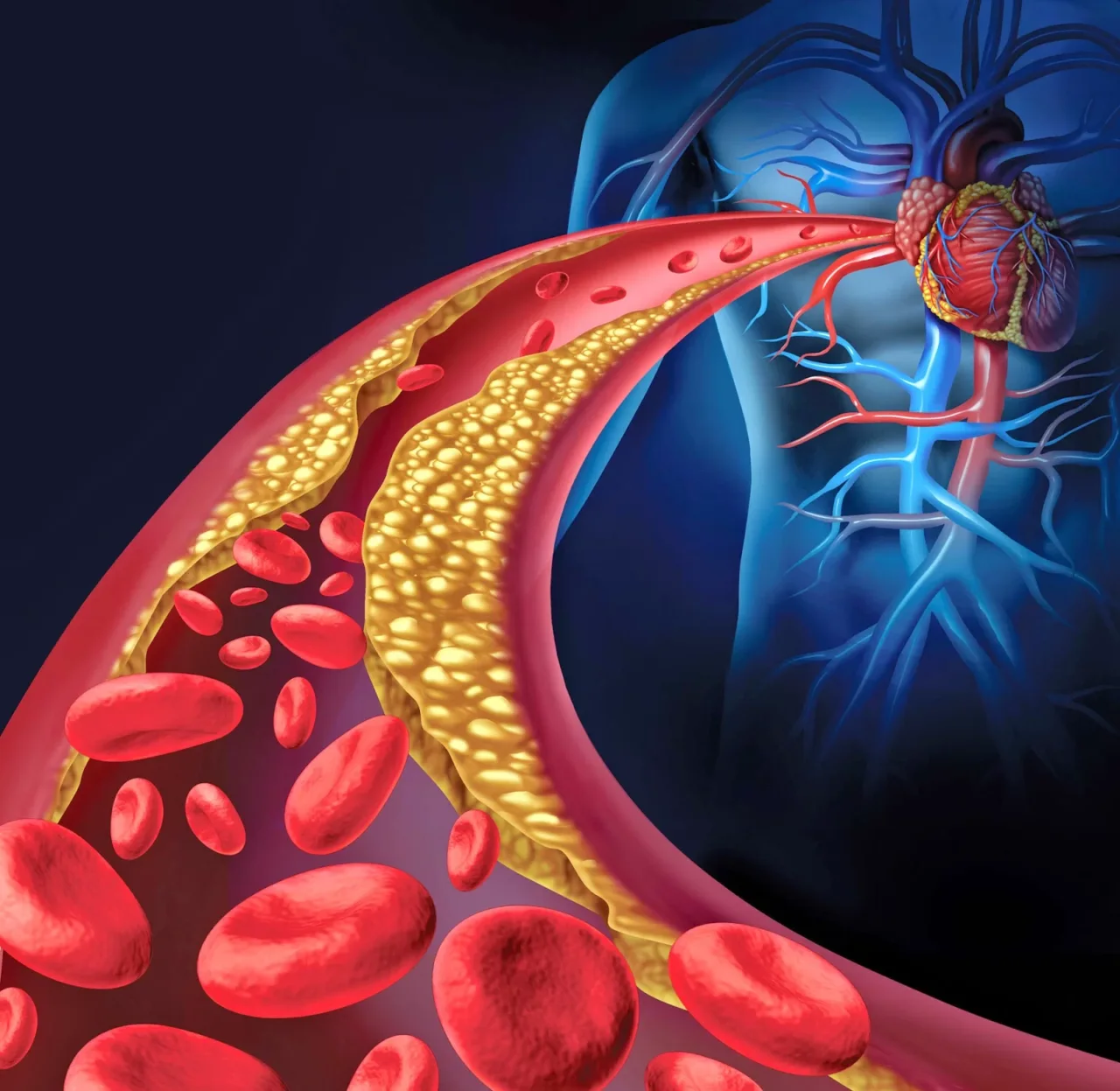 Riconosci subito un’ischemia: anche uno solo di questi sintomi può salvarti la vita