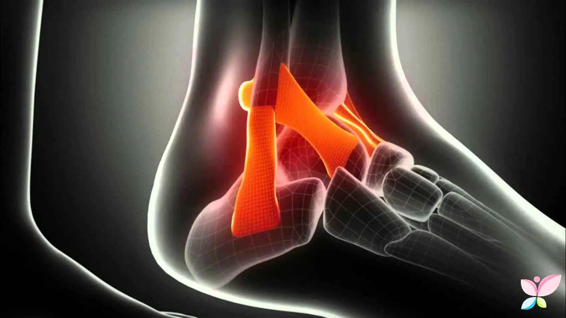 Come si fa a curare un’infiammazione al tendine d’Achille? I rimedi per il dolore al tallone